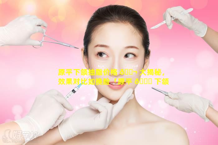 原平下颌抽脂价格 🐬 大揭秘，效果对比如换脸「原平 🐋 下颌抽脂价格大揭秘,效果对比如换脸」